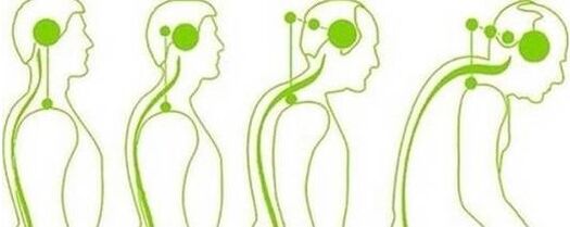 The cervical column loses mobility